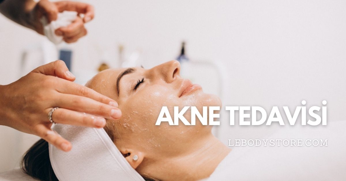 akne tedavisi
